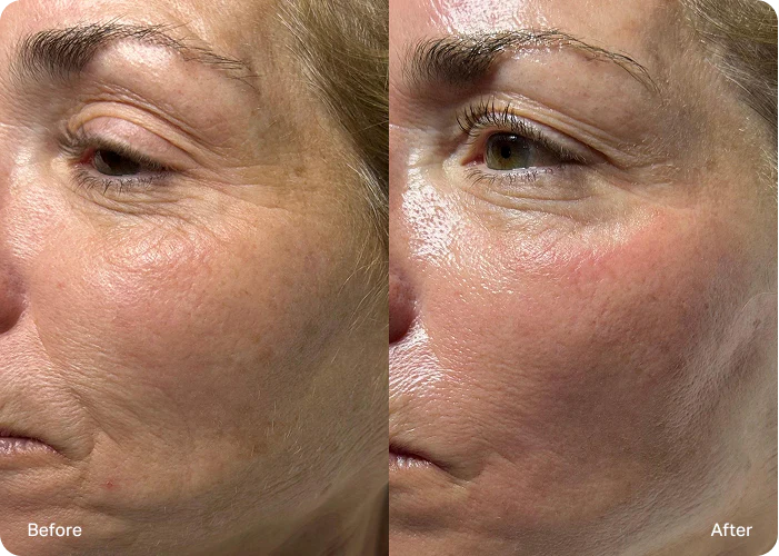 Korean Time Reverse Cream